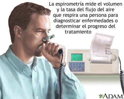 espiro